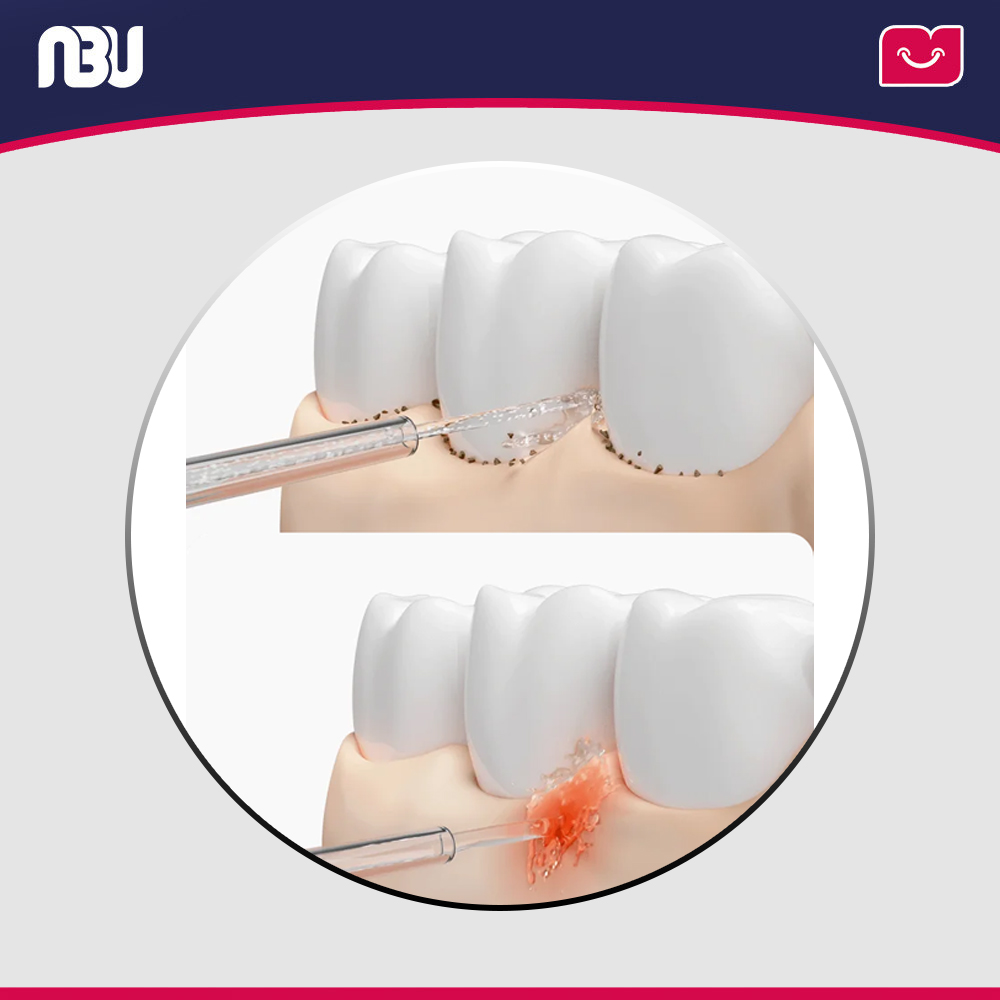 واترجت شستشوی دهان و دندان میجیا مدل Flosser2 کد MEO705 